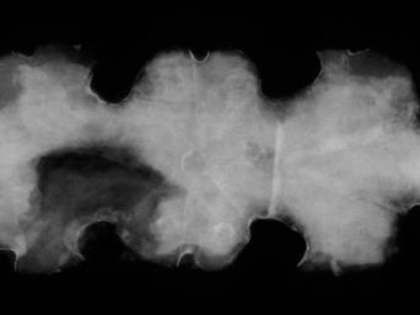 Rentgenový snímek železného cínovaného kování.