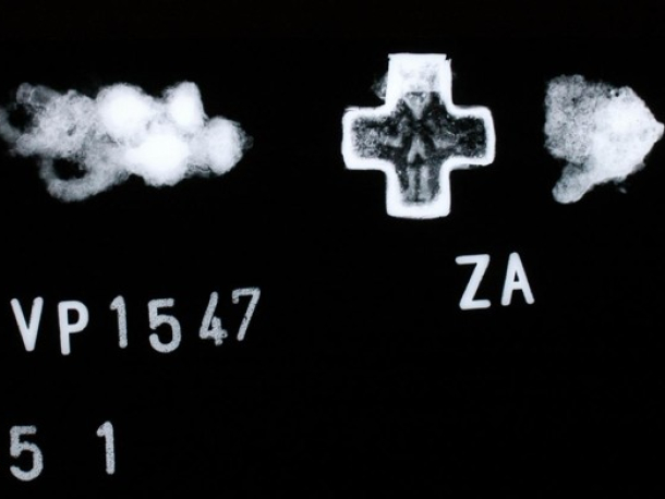 Rentgenový snímek zdobeného kování.