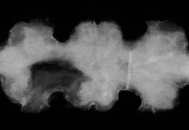 Rentgenový snímek železného cínovaného kování.